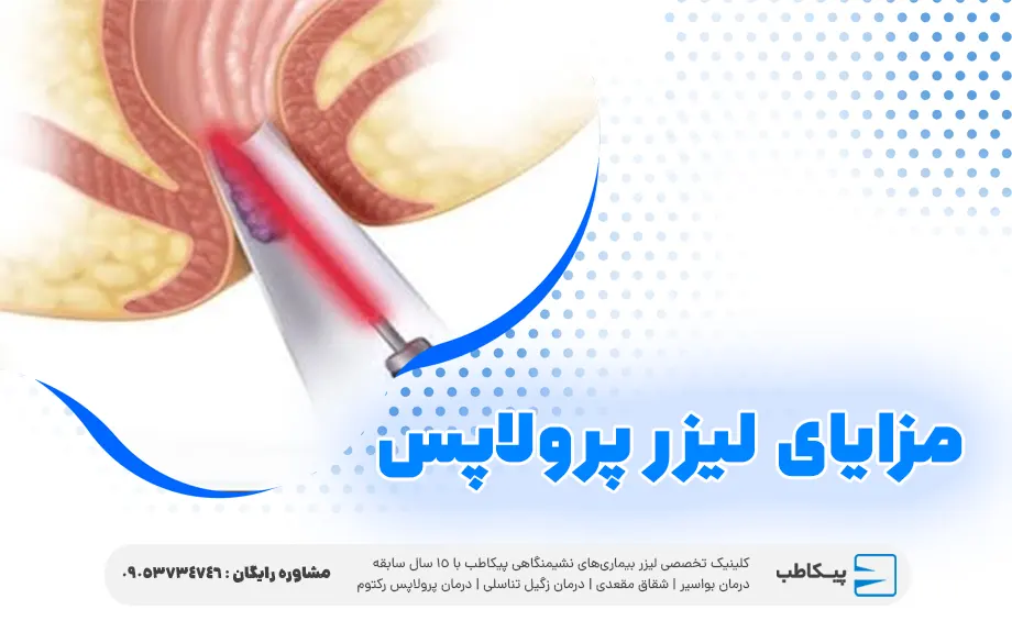 مزایای لیزر پرولاپس یا افتادگی رکتوم