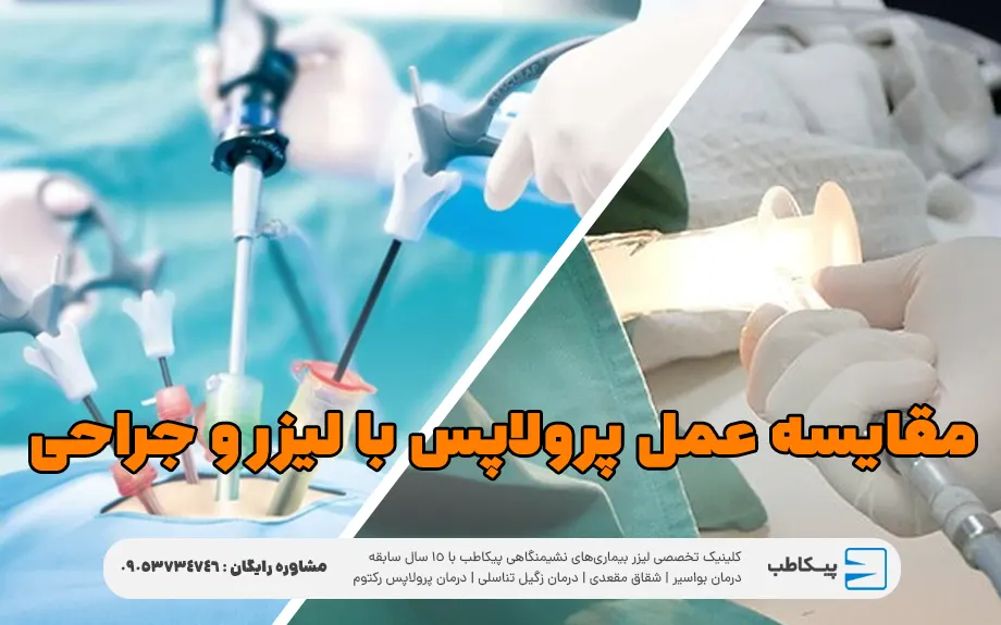 مقایسه عمل پرولاپس با لیزر و جراحی سنتی