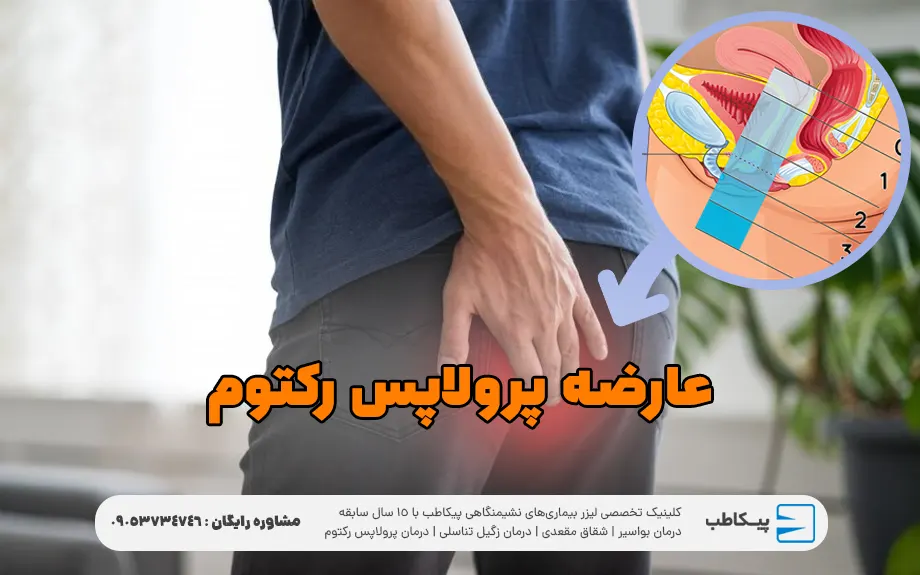 عارضه پرولاپس رکتوم