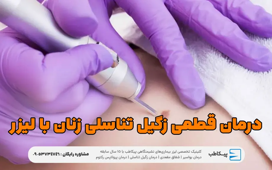 درمان قطعی زگیل تناسلی زنان با لیزر