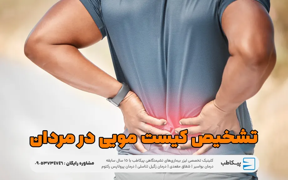 تشخیص کیست مویی در مردان