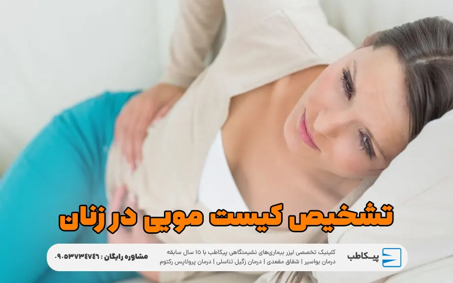 تشخیص کیست مویی در زنان