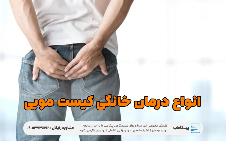 انواع درمان خانگی کیست مویی