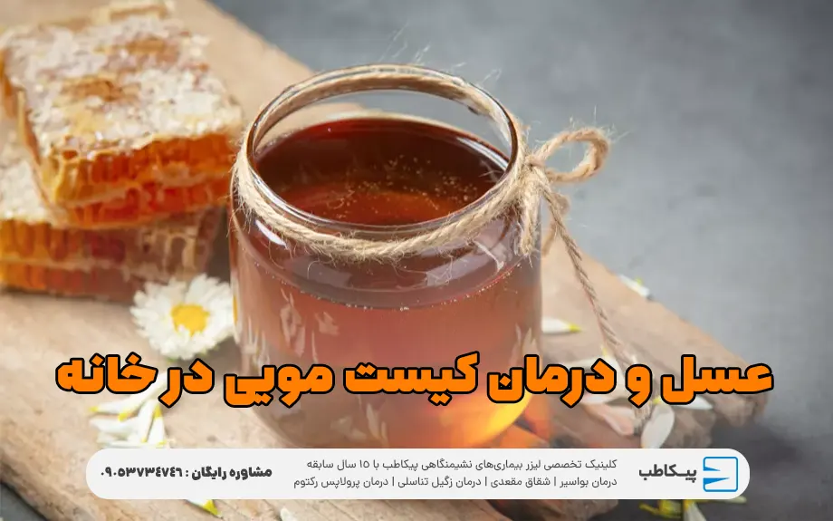 عسل و درمان کیست مویی در خانه
