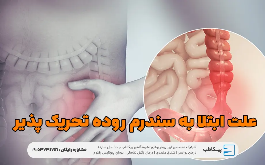 علت ابتلا به سندرم روده تحریک پذیر