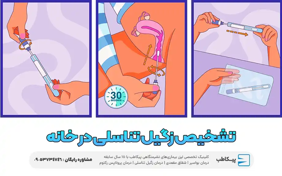کیت های تشخیص زگیل تناسلی در خانه