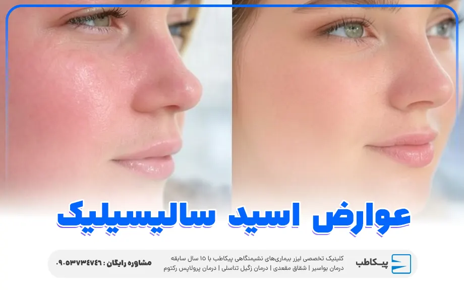 عوارض اسید سالیسیلیک
