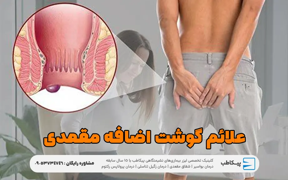 علائم گوشت اضافه مقعدی