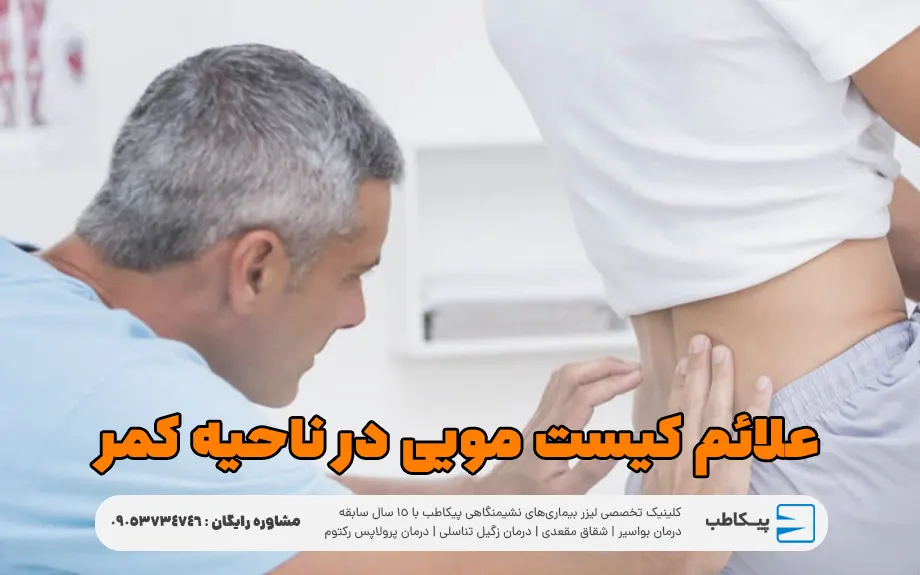 علائم کیست مویی در ناحیه کمر
