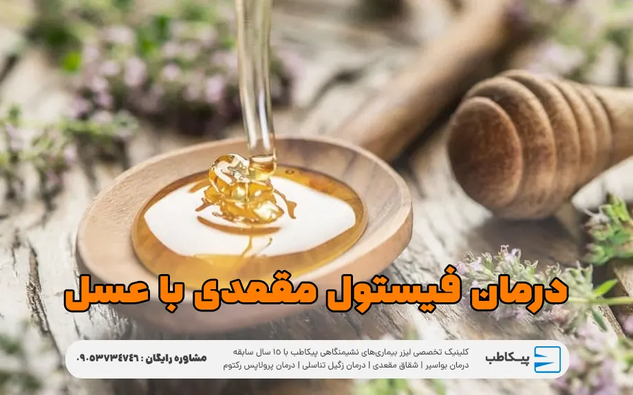 درمان فیستول مقعدی با عسل 