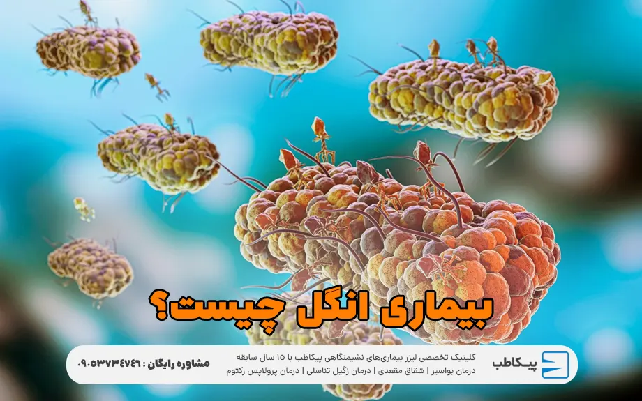 بیماری انگل چیست؟