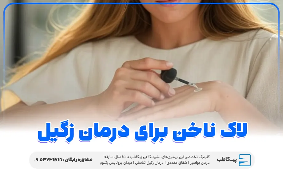 لاک ناخن برای درمان خانگی زگیل