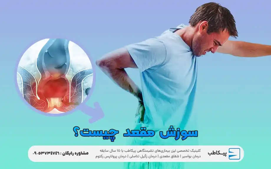 سوزش مقعد چیست؟