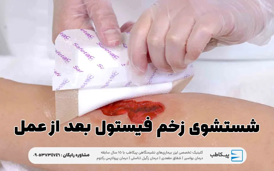 شستشوی زخم فیستول