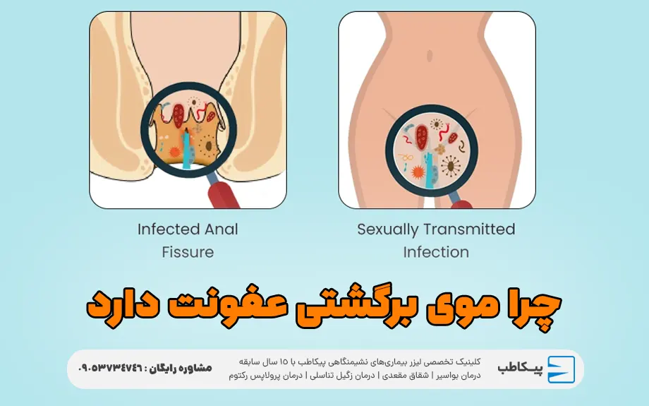 چرا موی برگشتی عفونت دارد؟