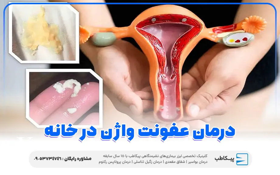 درمان عفونت واژن در خانه
