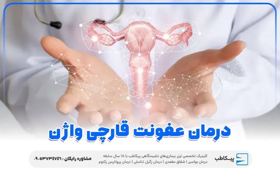 درمان عفونت قارچی واژن