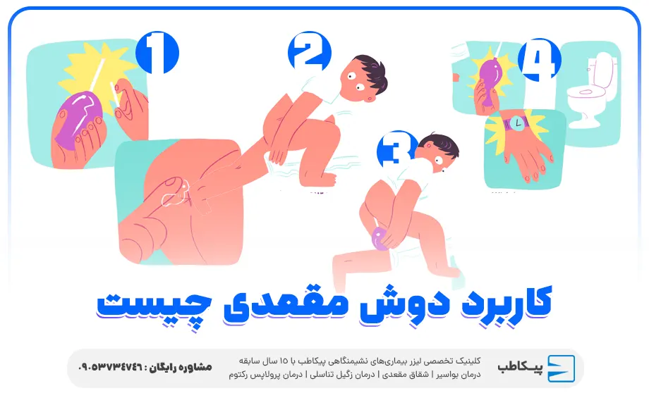 کاربرد دوش مقعدی چیست