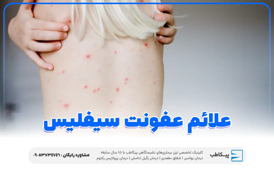 علائم عفونت سیفلیس