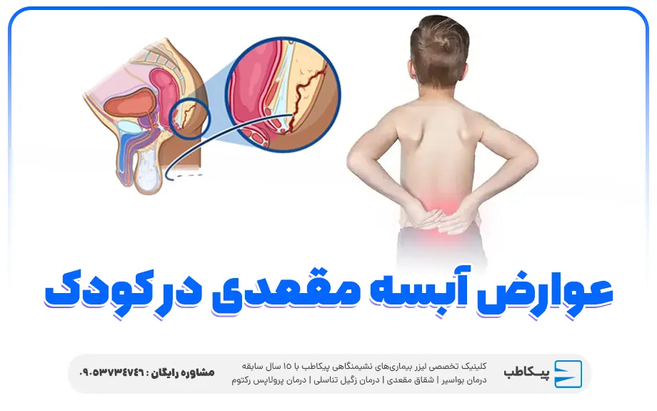 عوارض آبسه مقعدی در کودک