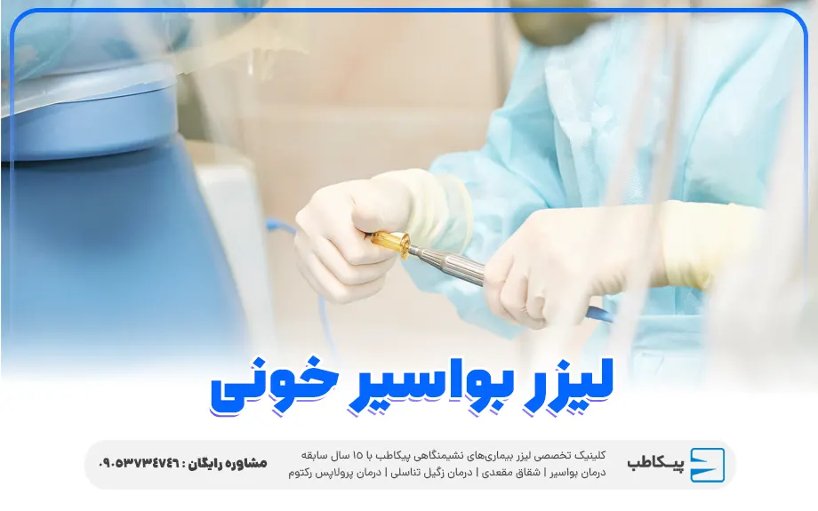 لیزر بواسیر خونی