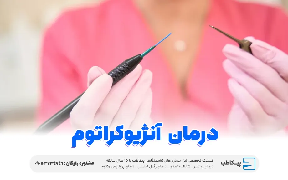 درمان آنژیوکراتوم