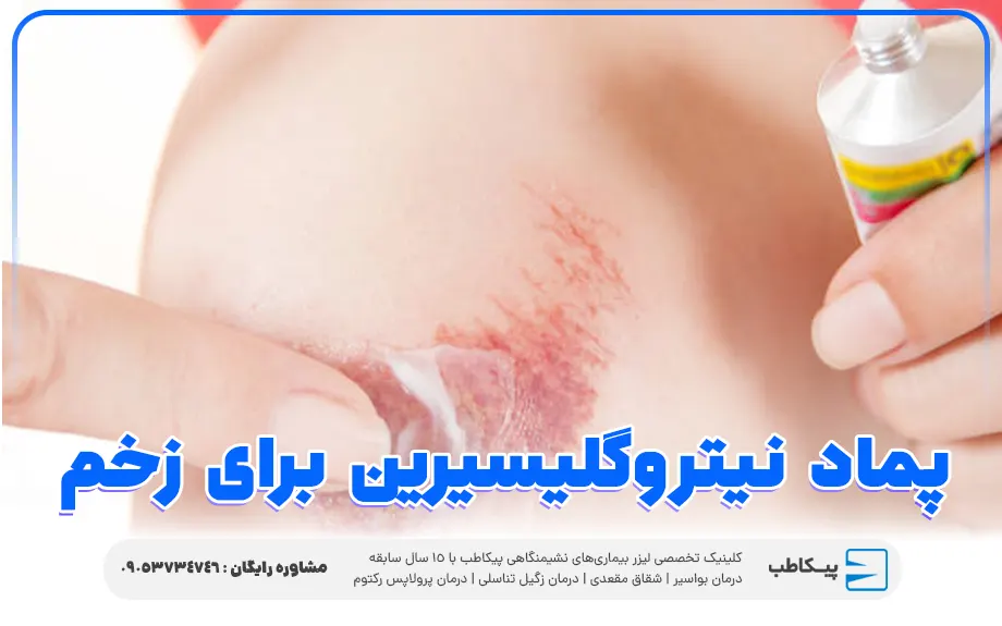 پماد نیتروگلیسیرین برای زخم